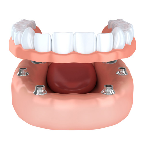 Denture Services in Mulund