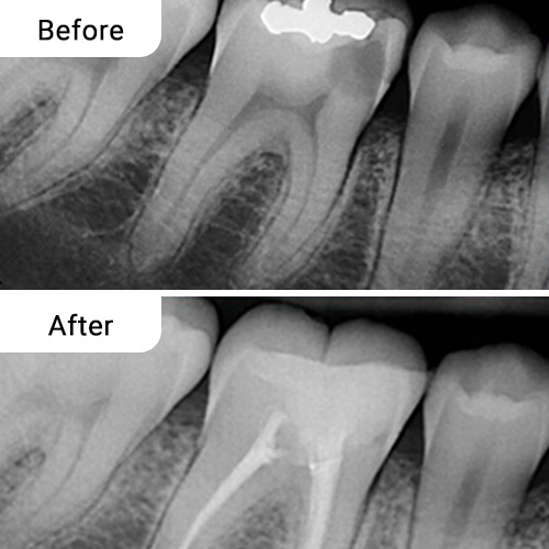 Before and After Dental Treatment