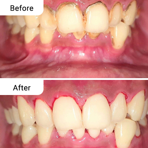 Before and After Dental Treatment