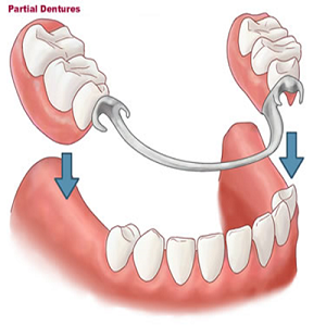 Denture Services in Mulund