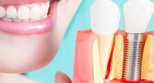 Dental Clinic in Mulund